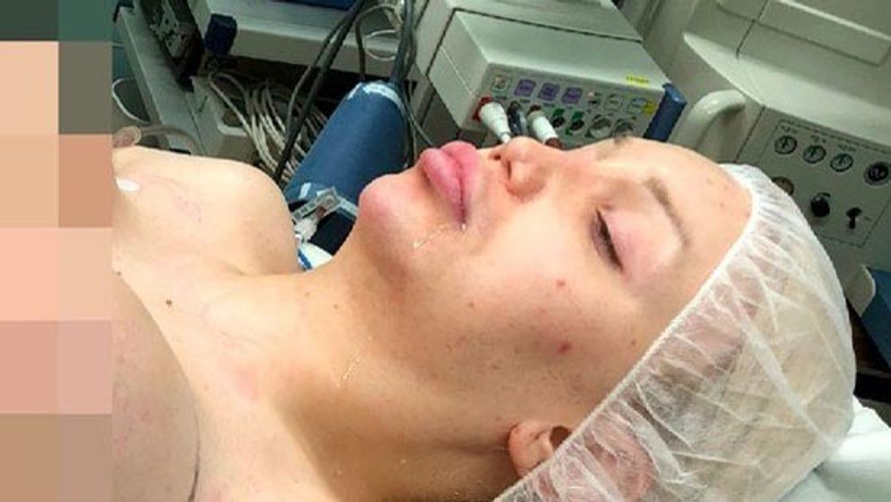 Drobné telo modelky neustálo obrie implantáty. Akútna operácia