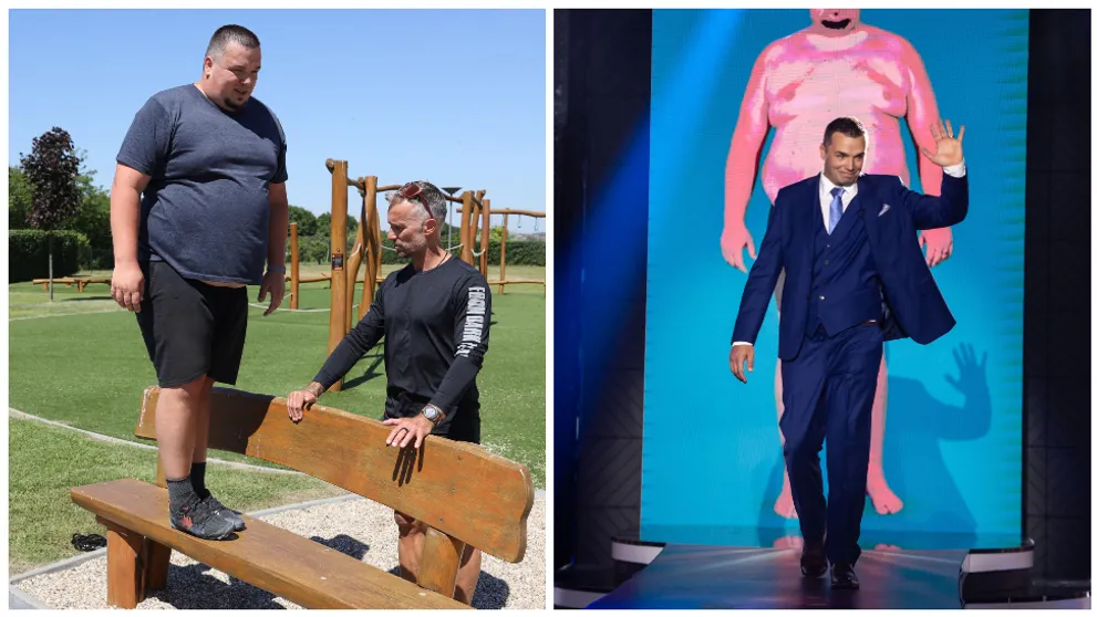 Zábery tesne po plastickej operácii: Takto vyzerá Martin s novým telom