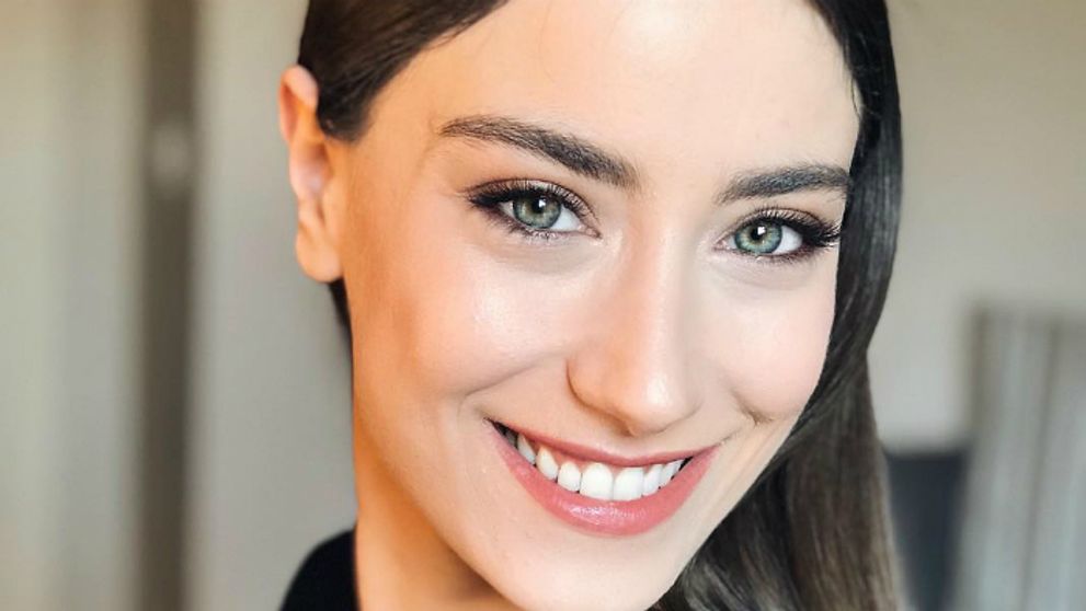 Z Ferihy je ryšavka: Vyzerá ako bohyňa