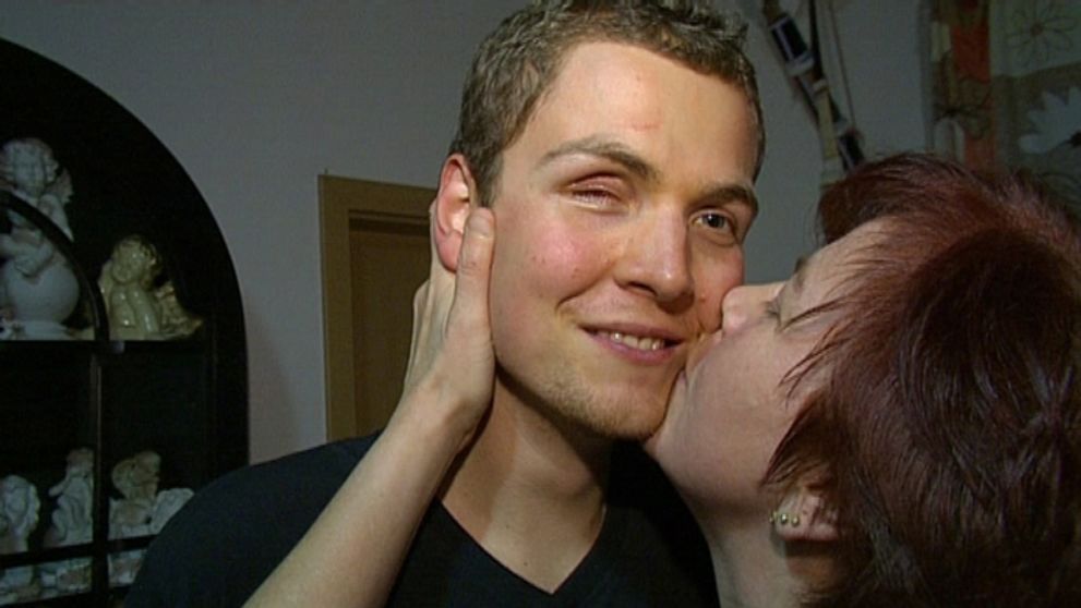 Na nádory so surovou stravou