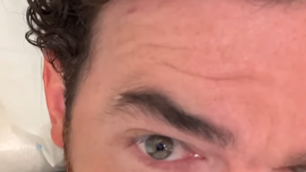 Spevák priznal, že má rakovinu. Už ho stihli aj operovať