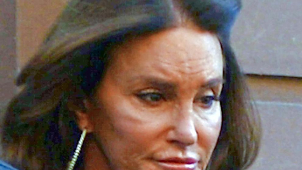Čo urobí množstvo plastík! Nechutne hrboľatá Caitlyn Jenner