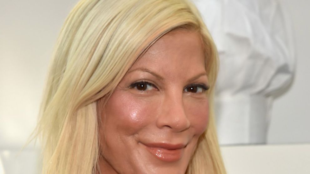 Otrasná tvár hviezdy Beverly Hills 902 10 vás šokuje