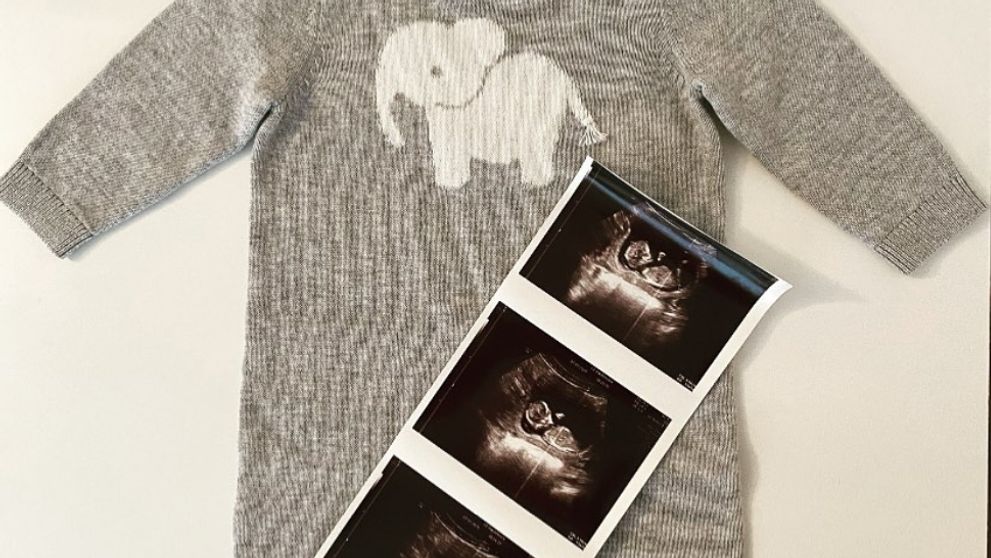 Ďalšia hviezda Harryho Pottera bude prvýkrát otcom