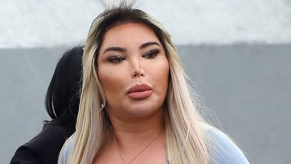 Žiadny Rodrigo Alves, ale Roddy: Nos takmer žiadny, prsia zato gigantické