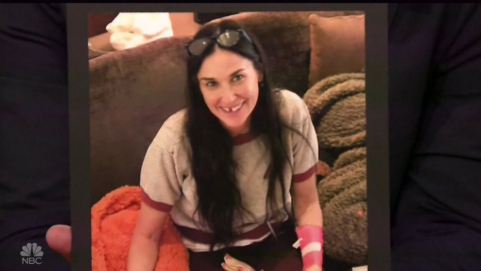 Demi Moore prišla o predné zuby. Môže za to choroba