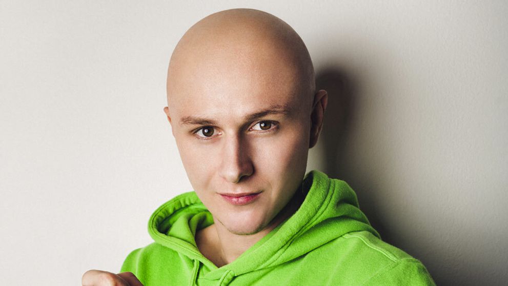 Po roku opäť s holou hlavou! Na staronový imidž sa veľmi tešil