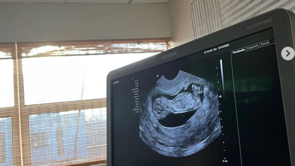 Namiesto rakety kočík. Slávna tenistka sa stane prvýkrát mamou