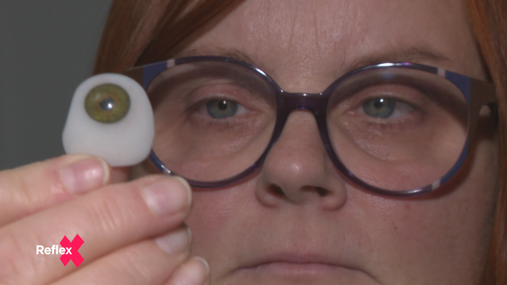 Jej oči pomáhajú iným lepšie žiť