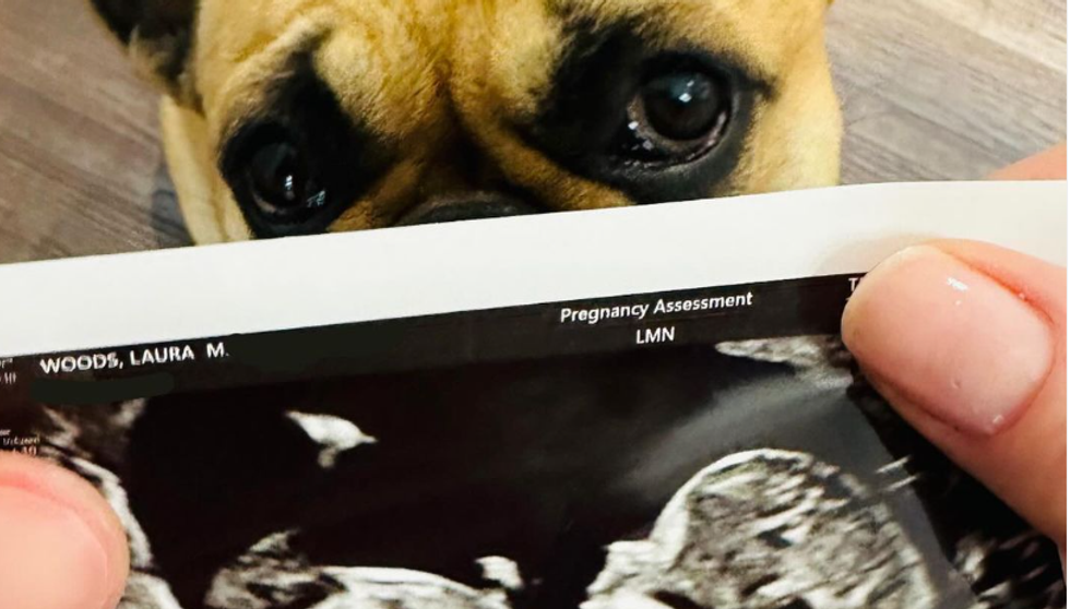 Moderátorka a hviezda šou Love Island čakajú dieťa: Dokopy sa dali pred 10 mesiacmi