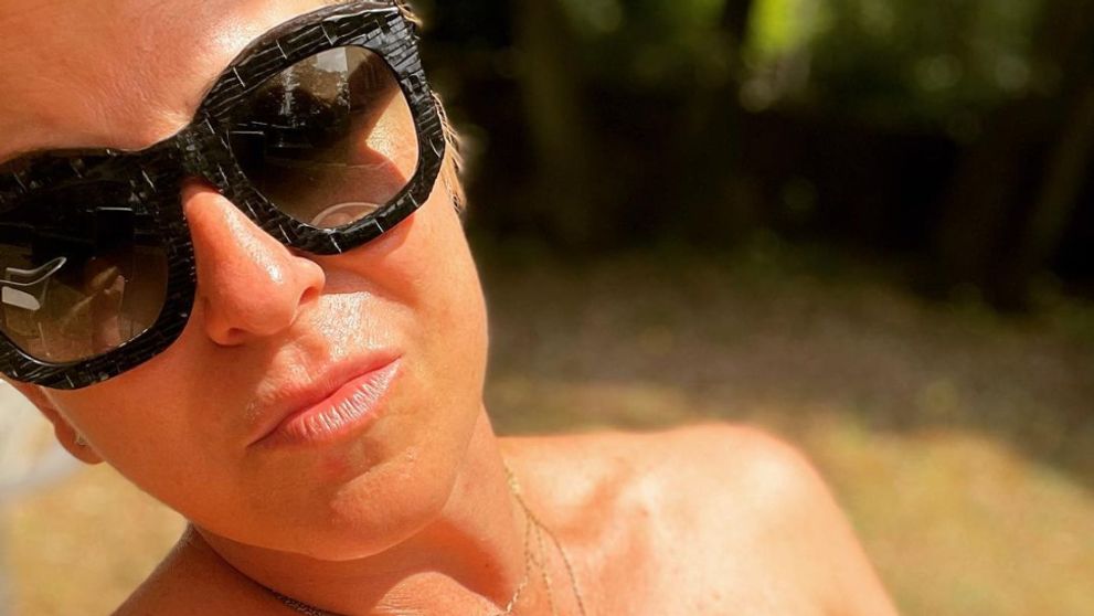 Mala to byť dovolenka snov. Wanda Hrycová skončila v hroznom stave nemocnici