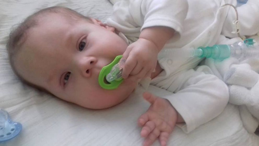 Majko prišiel na svet s telíčkom plným nádorov. Čaká ho ešte náročná cesta