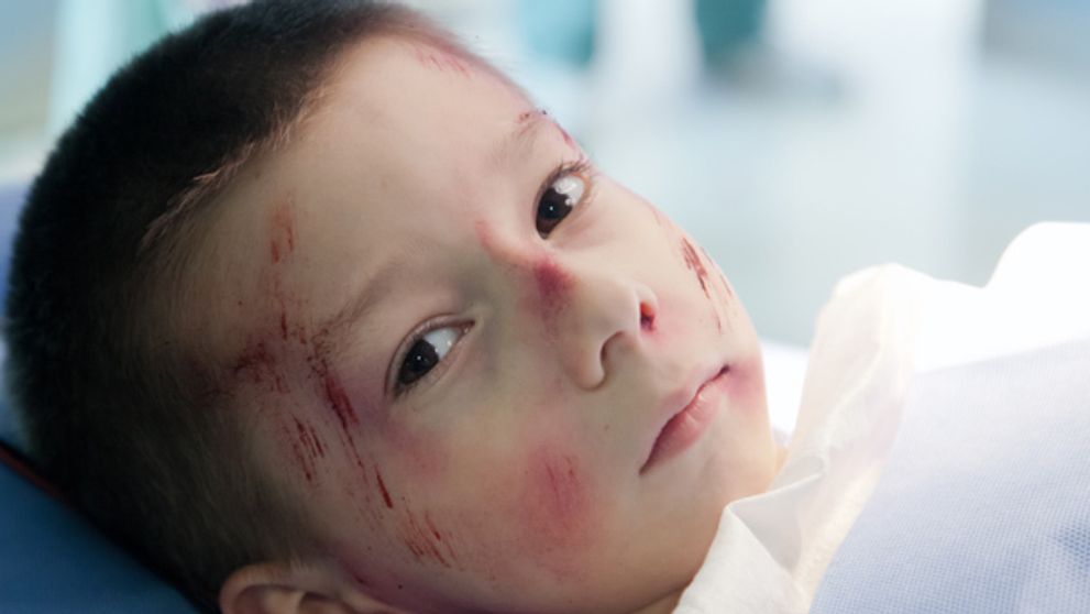 Skončí malý Paľko na vozíčku?