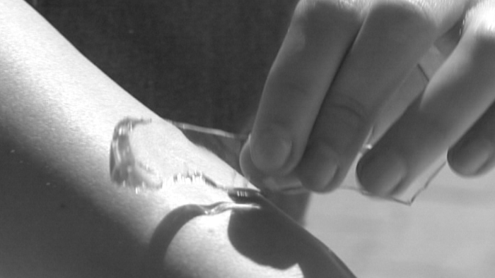 Samopoškodzovanie detí