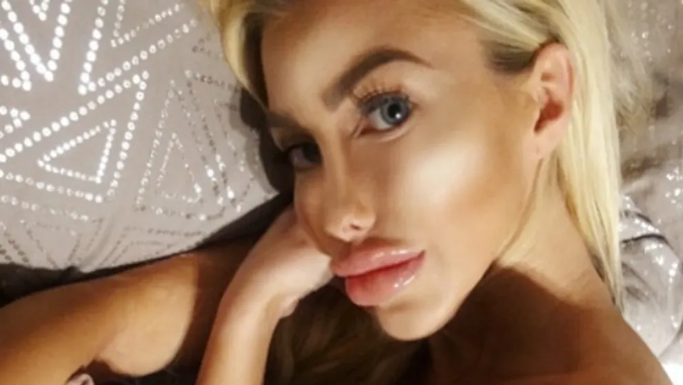 Nechutná poľská Barbie: Nohy ako palice, vysekaná sánka a pery cez pol tváre