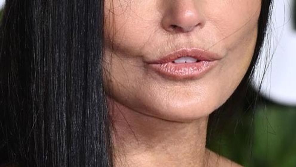 Niekto vie zostať večne mladý nenápadne, niekto nie: Demi Moore šokovala úpravou