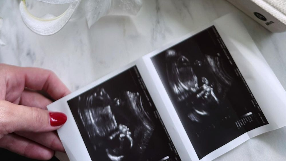 Herec sa teší na bábätko s novou manželkou: Krásna gratulácia od bývalej