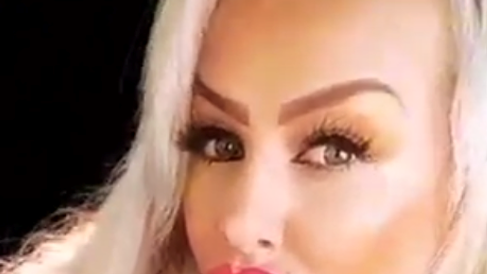 Exfarmárka má pery až po nos. Ani Kucherenko sa na ňu nechytá