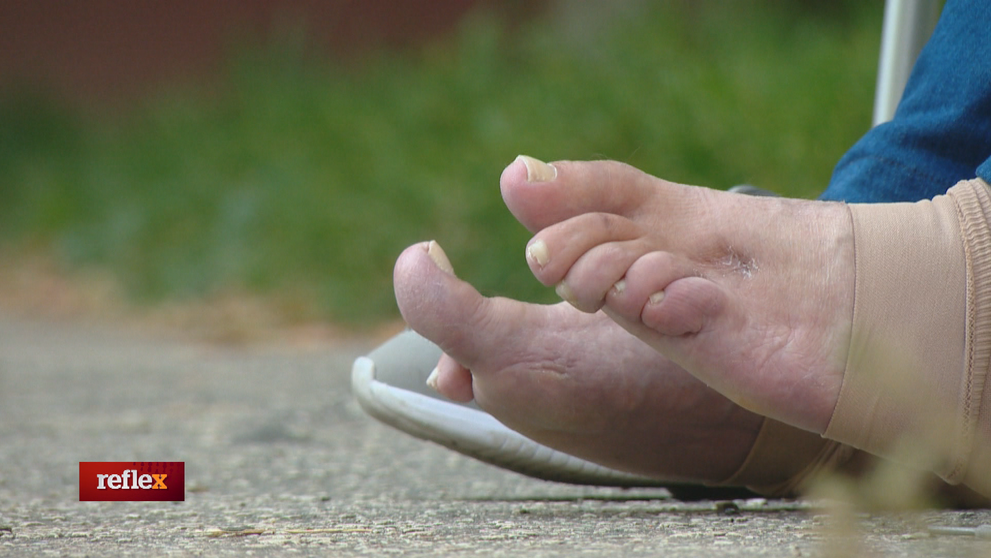 Operácia jej nepomohla