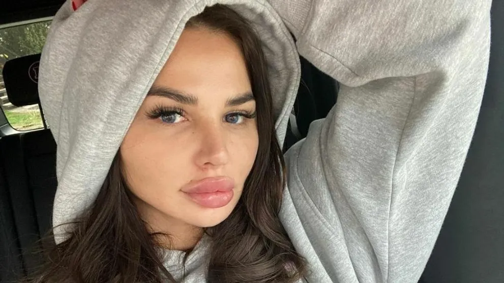 Zabudnite na zväčšené pery a umelé vlasy: Zuzka Plačková má na zmenu pádny dôvod!