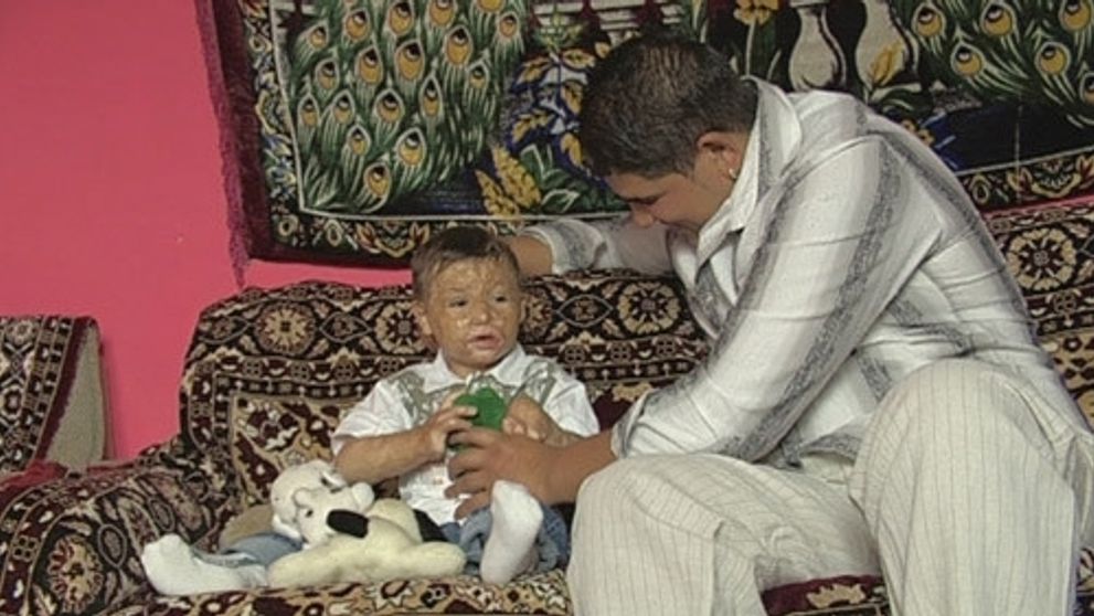 Osemmesačný Milanko takmer zhorel!