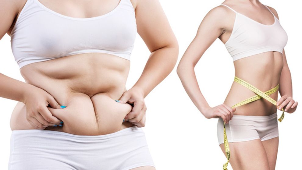 Ste obézny? Možno za to naozaj môžu vaše gény!