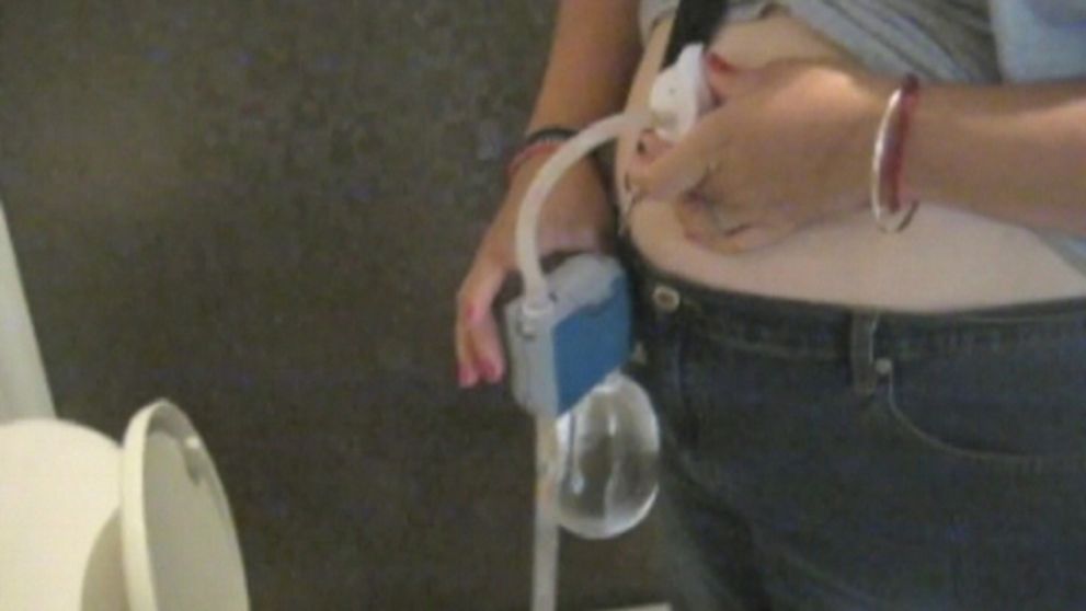 Kontroverzné metódy chudnutia