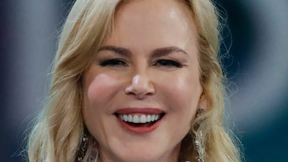 Nicole Kidman sa len pár dní po Oscaroch na seba vôbec nepodobá. Plastiku nepoprie