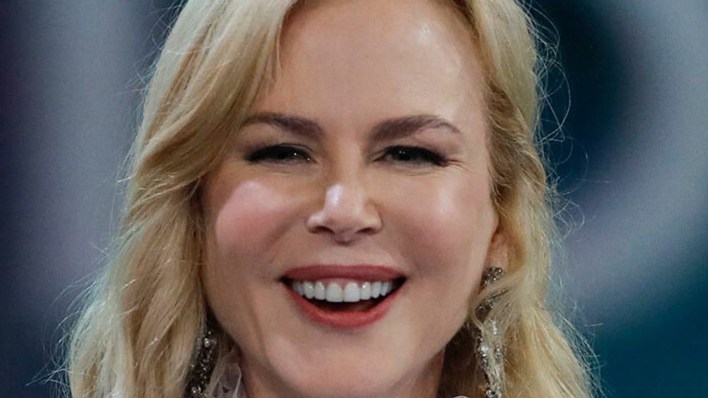 Nicole Kidman sa len pár dní po Oscaroch na seba vôbec nepodobá. Plastiku nepoprie