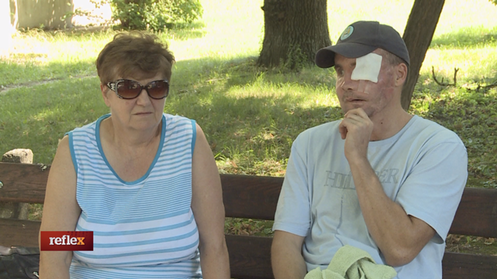 Príšerná autonehoda ho pripravila o polovicu tváre