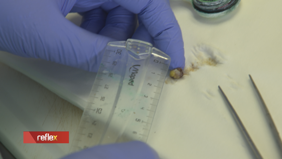 Zdravie alebo peniaze