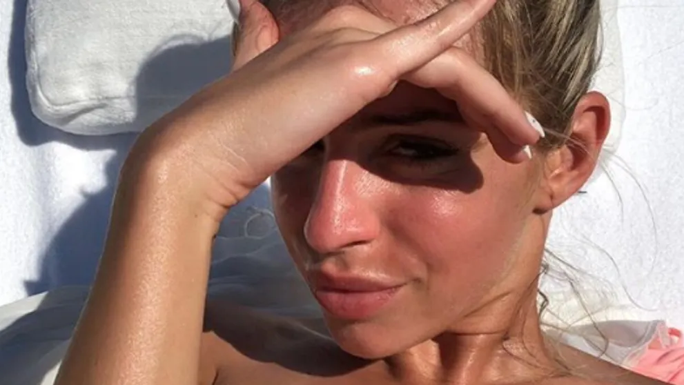 Horúci záber Tatarovej priateľky Lucie. Prsia jej zakryli iba čerešne