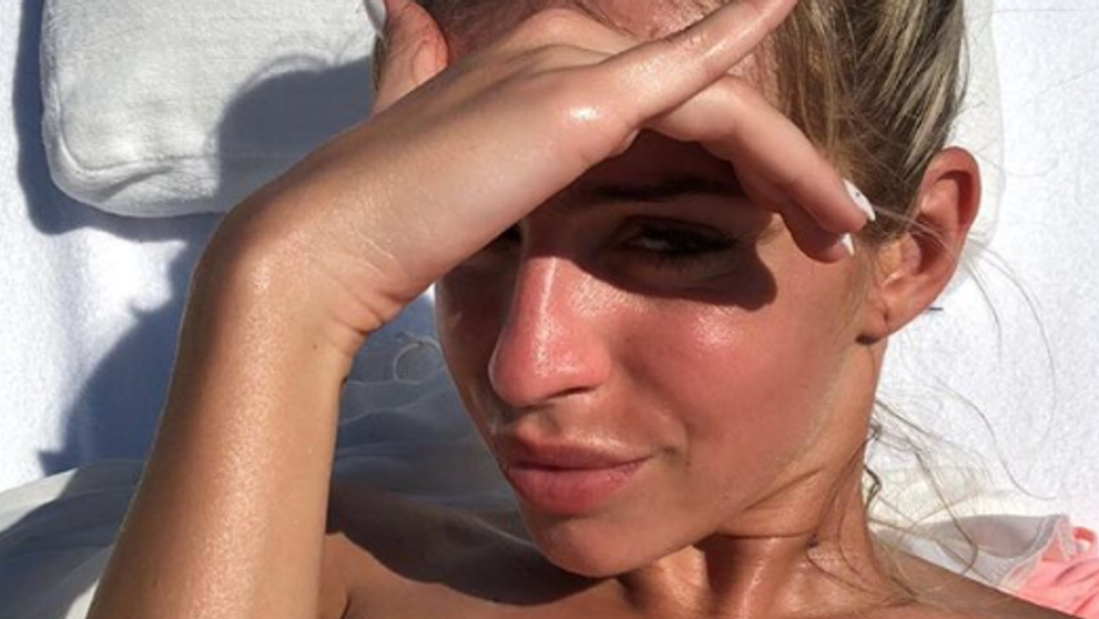 Horúci záber Tatarovej priateľky Lucie. Prsia jej zakryli iba čerešne