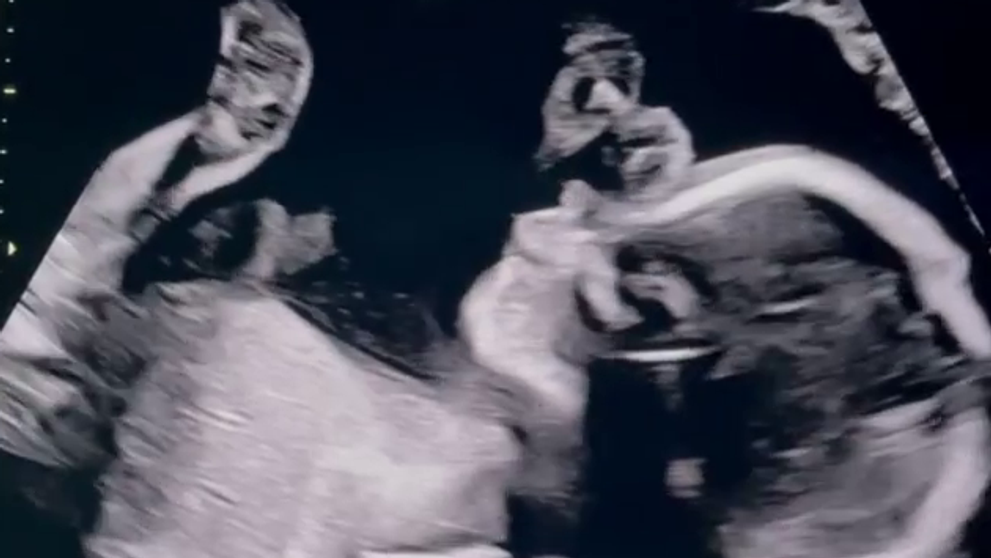 Prešli si niekoľkými potratmi a teraz? Dieťa číslo 3 je na ceste