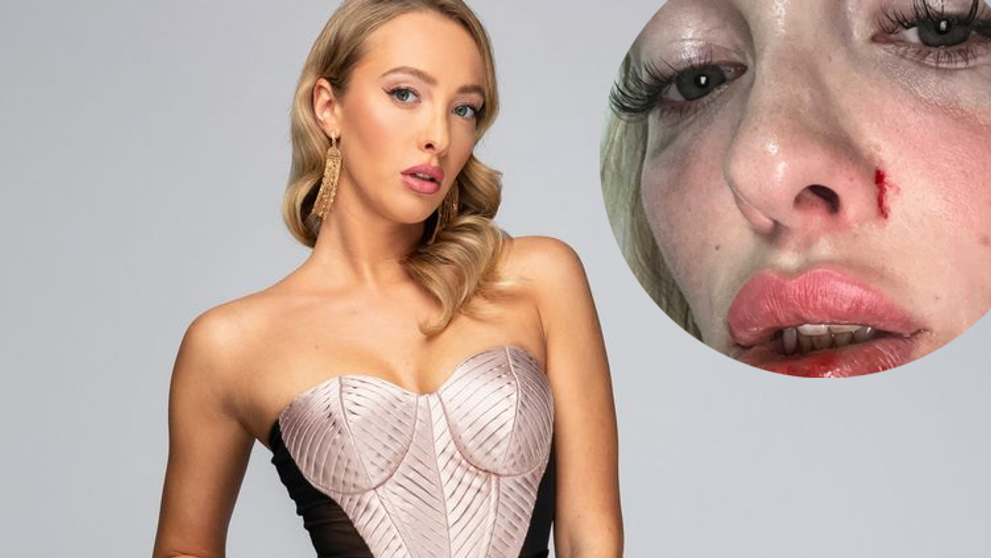 Fergie napadla na dovolenke neznáma žena: Opísala nám, ako veľmi sa jej to dotklo