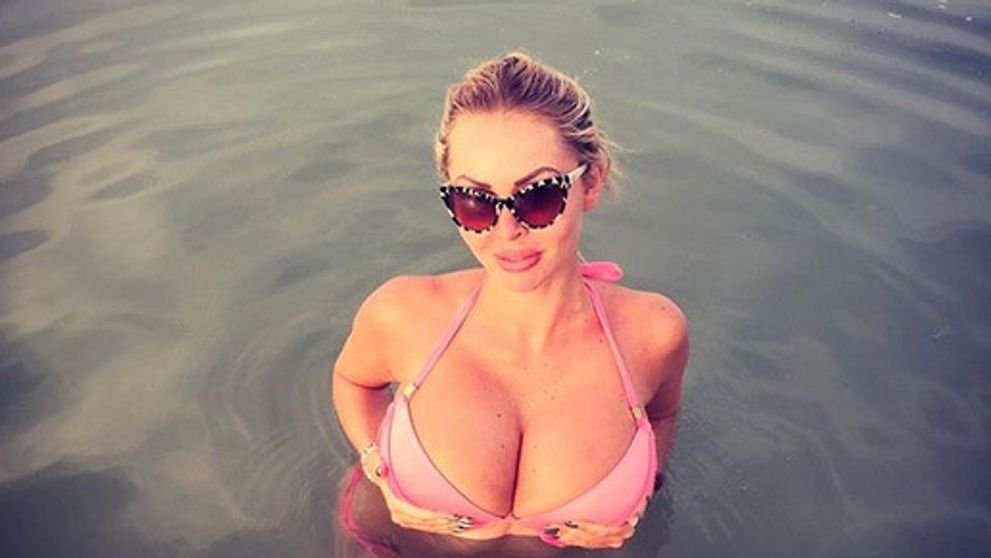 Mia mala najväčšie silikóny na Slovensku aj v Česku. Ukázala ich po zmenšení