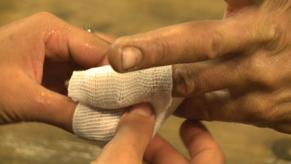 Aby sme náhodou nevyšli z cviku: Klinec zabodnutý v prste!