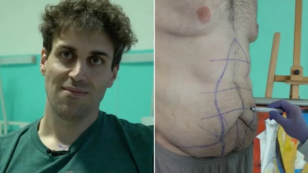 Stano ukázal nové telo po operácii: Už teraz vie, čo chce s ním vyskúšať!