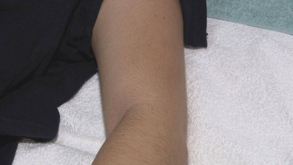 Chlpy na tele: Sú naozaj nepriateľom...?