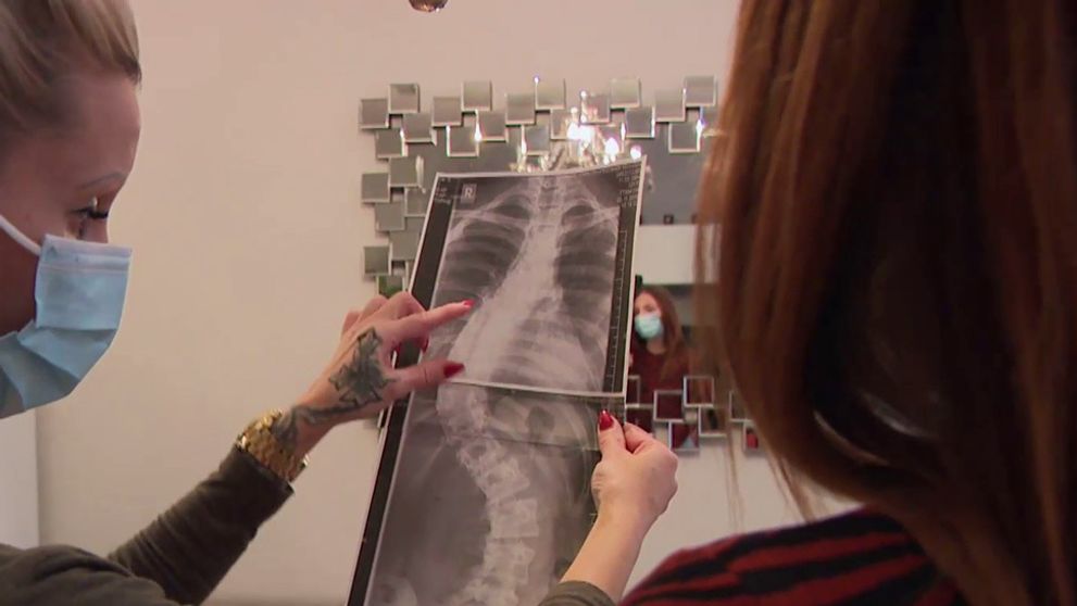 Operácia chrbtice ju navrátila do života