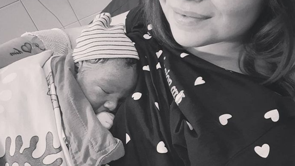 Superstaristke sa narodil synček: Bude musieť podstúpiť plastický zákrok