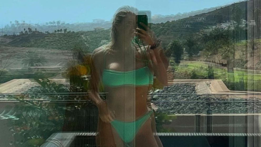 Nakrúcanie Love Islandu v ohrození? Úraz pred štartom všetko skomplikoval