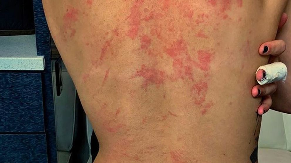 Nahá liezla po skalách a spadla. Speváčka zverejnila nelichotivé zábery