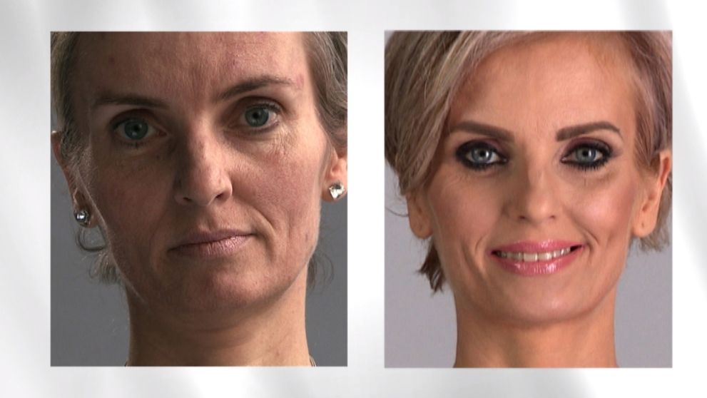 Vďaka premene sa jej konečne zmenil život: Pozrite si výsledok!