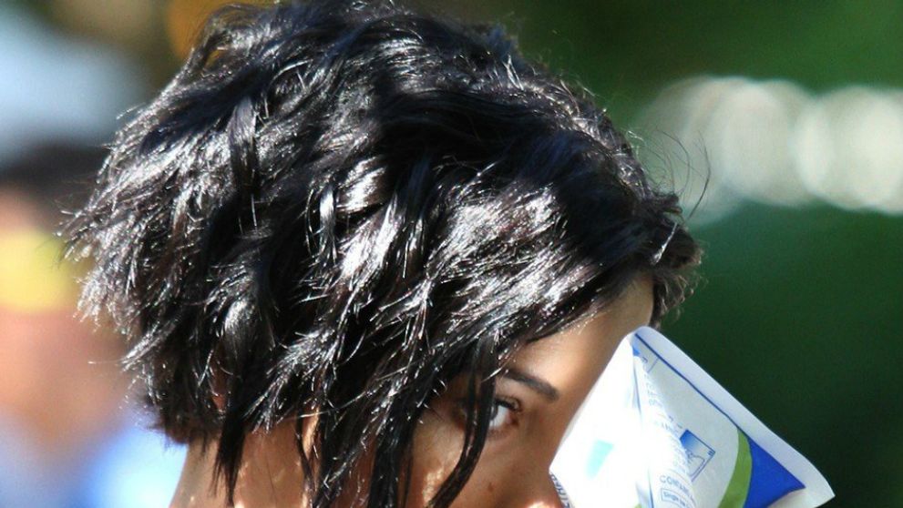 Au, to muselo bolieť: Seriálová kráska si pri nakrúcaní zlomila nos