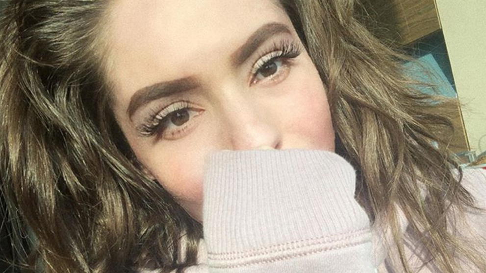 Česká hviezda, ktorú popálili na dovolenke, sa dočkala. Veľký návrat