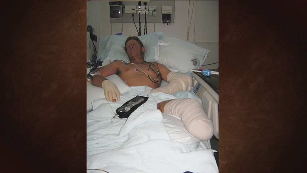 Survivor je späť! Medzi účastníkmi je aj muž, ktorý prišiel o obe nohy