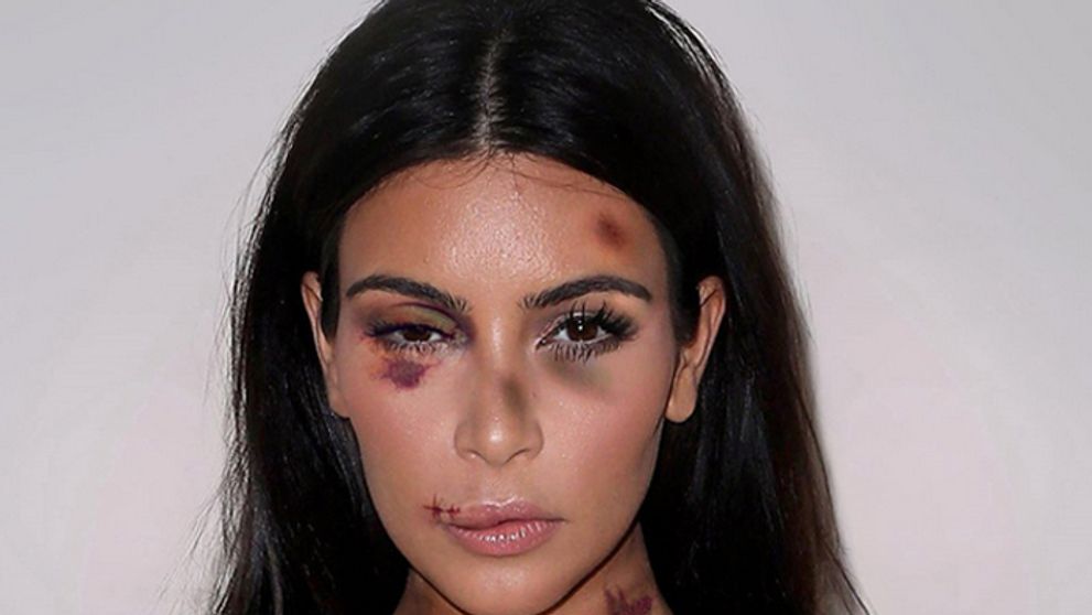 Internetom kolujú šokujúce snímky zbitej Kim Kardashian a Kendall Jenner