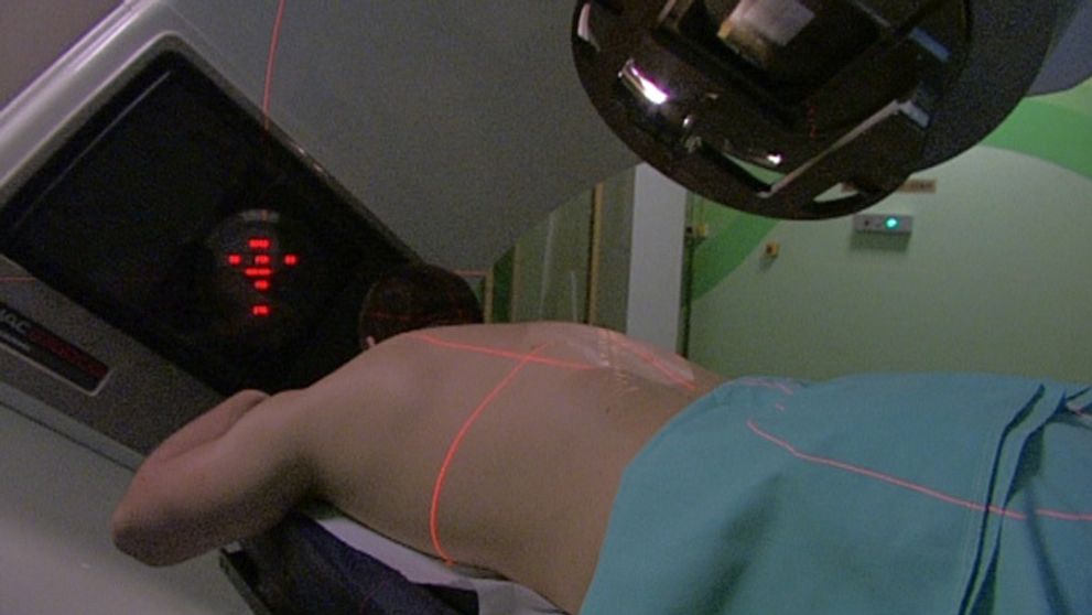 Rakovine pankreasu podľahne 95% pacientov