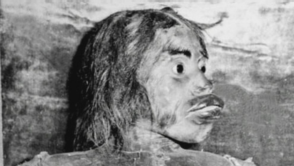 Volali ju medvedia alebo opičia žena